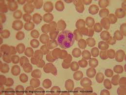 109-segmen-neutrophil