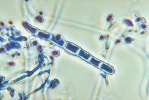 117-trichophyton-rubrum