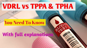 164-vdrl-tpha